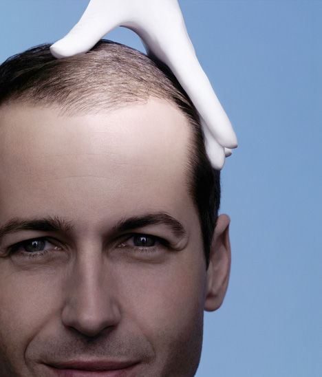 saç dökülmesi saç dökülmesi