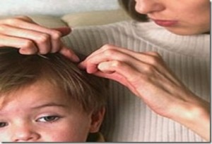 Elma sirkesi biti öldürür mü