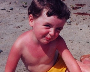 Güneş kızarıklığına ne iyi gelir