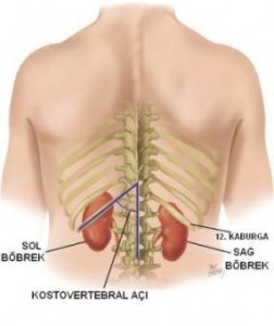 Böbrek küçülmesinin tedavisi
