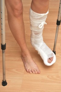 Ayaktan Alçı Nasıl Çıkar