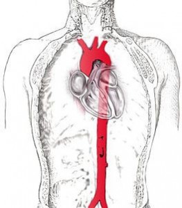 aort-semasi