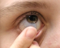 Göz yanması neden olur? Tedavisi nedir?