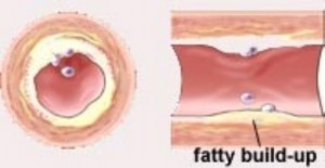 Kalp yağlanması belirtileri