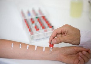 alerji-testi
