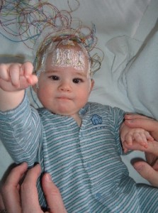 EEG çekimi öncesi hazırlık nasıl olur?