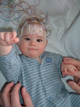 Bebeklere EEG Çekimi Nasıl Olur?
