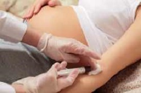 Doğum Öncesi DNA Testi Nasıl Yapılır?
