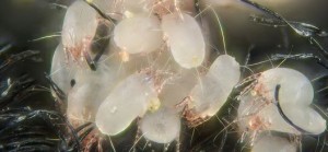 Alerjisi olanlar yün yorgan, halı kullanmasın!