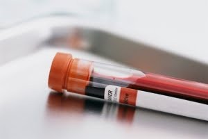 Kan Testinde Gebelik Kaç Gün Sonra Çıkar?