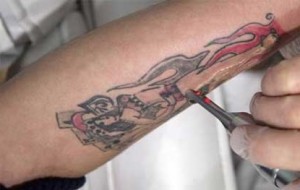 Kalıcı dövmeleri silen krem