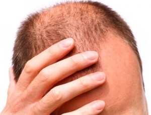 Saç dökülmesine iyi gelen bitkiler