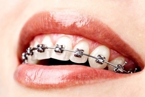 2015 Diş Teli Fiyatları