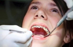Ortodonti Tedavisini SGK öder mi?