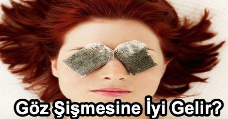 Göz Şişmesi