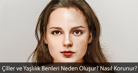 Çiller ve Yaşlılık Benleri