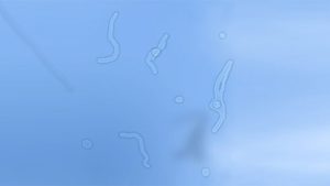 Gözlerde Beyaz Benek Lekeler