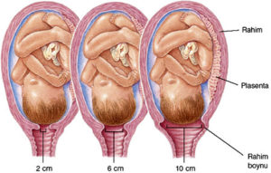 Normal Doğumda Açılma Ne Kadar Olmalı?