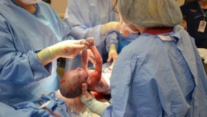 Sezeryanla Doğum Kaçıncı Haftada Olur?